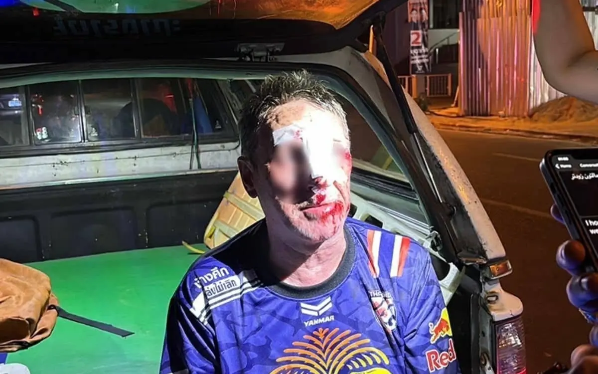 Am Kopf böse verletzt: Sicherheitsbedenken über Pattayas Gehwege nach Sturz eines ausländischen Touristen in ungeschützte Grube