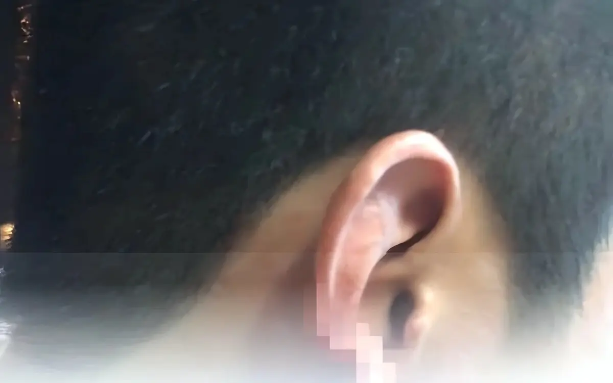 Angriff in Chiang Mai: Betrunkener Thaiboxer beißt Ohr ab und erinnert an Mike Tyson