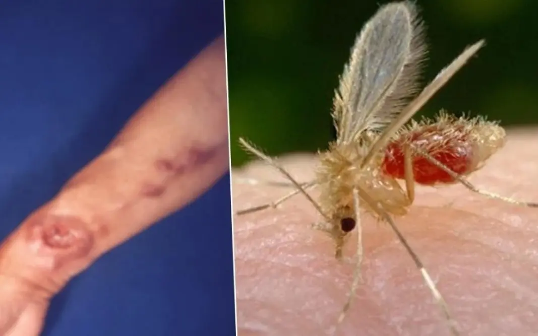 Urlaubshorror: Sandfliegen übertragen tödliche Parasiten