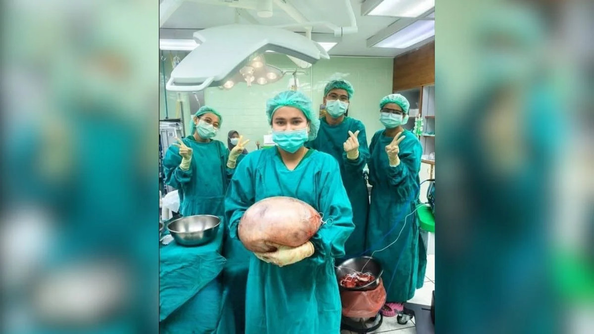 Frau lebt mit 30 cm großer Zyste – jahrelang unbemerkt