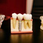 Zahnersatz in Thailand: Was Implantat & Krone kosten Deutschsprachige Zahnärzte in Thailand