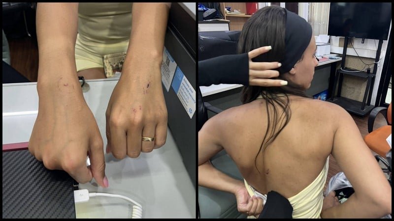 Brutale Attacke auf Bangla Road in Phuket: Ausländerinnen verprügelt