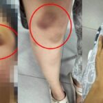 Horror in Korat: Polizist misshandelt Freundin mit Crystal Meth