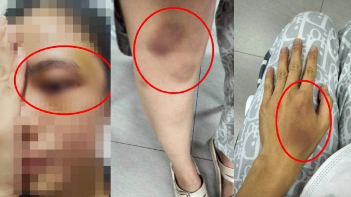 Horror in Korat: Polizist misshandelt Freundin mit Crystal Meth