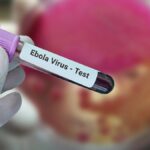 Ebola-Alarm: Ärztekammer warnt vor gefährlichem Ausbruch