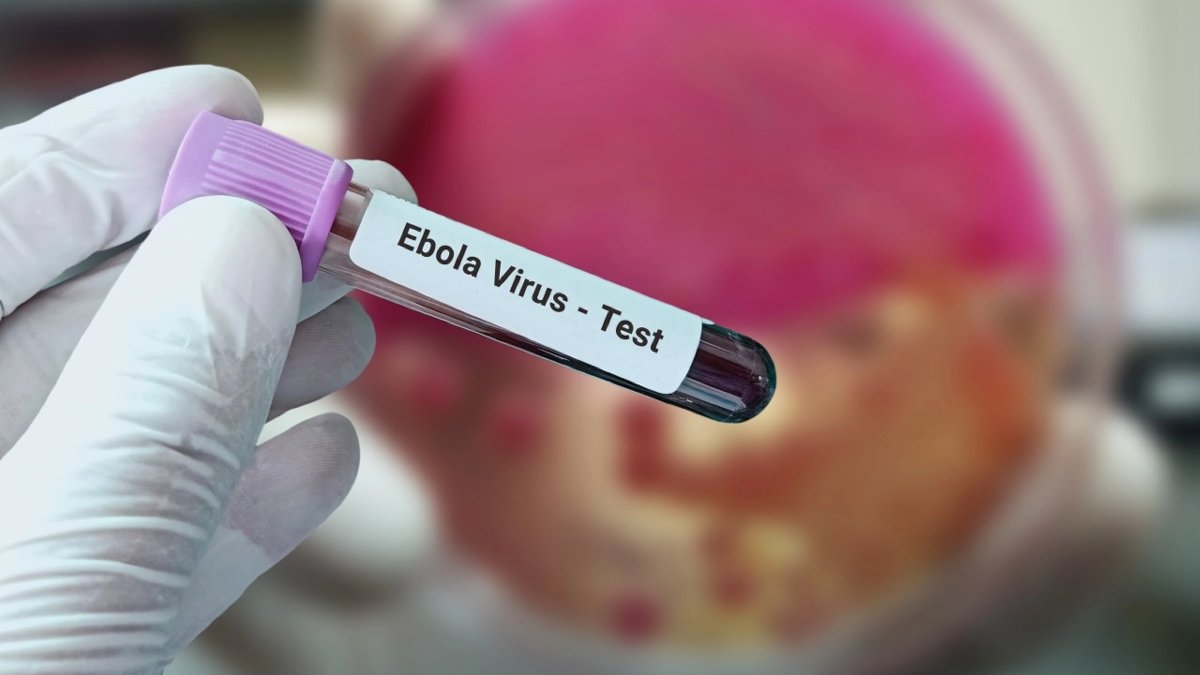 Ebola-Alarm: Ärztekammer warnt vor gefährlichem Ausbruch