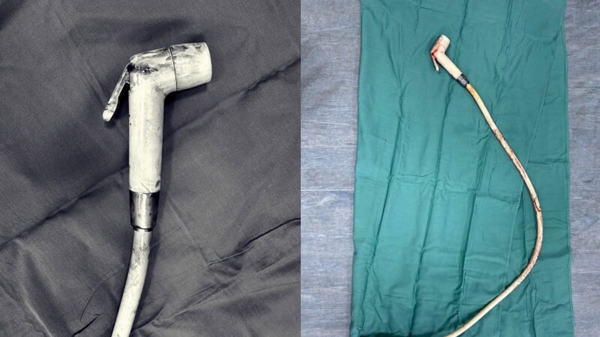 Schock-OP: Mann steckt Duschkopf im Hintern fest